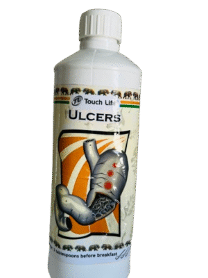 ULCERS