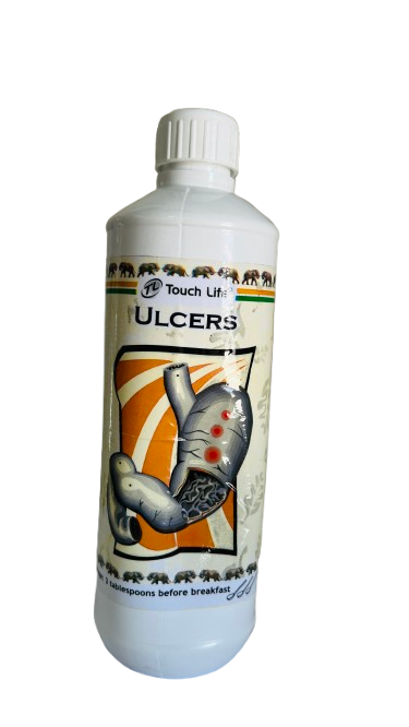 ULCERS